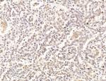 PRDM2 Antibody in Immunohistochemistry (Paraffin) (IHC (P))