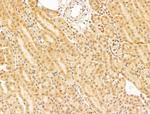 PRDM2 Antibody in Immunohistochemistry (Paraffin) (IHC (P))