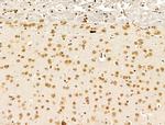 PRDM2 Antibody in Immunohistochemistry (Paraffin) (IHC (P))