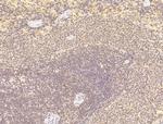 PRDM2 Antibody in Immunohistochemistry (Paraffin) (IHC (P))