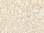 PRDM2 Antibody in Immunohistochemistry (Paraffin) (IHC (P))