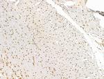 PRDM2 Antibody in Immunohistochemistry (Paraffin) (IHC (P))