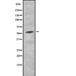 AMPK alpha-2 Antibody in Western Blot (WB)