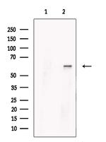 PRMT3 Antibody in Western Blot (WB)