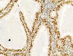 PRMT5 Antibody in Immunohistochemistry (Paraffin) (IHC (P))