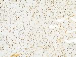 PRMT5 Antibody in Immunohistochemistry (Paraffin) (IHC (P))