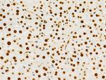 PRMT5 Antibody in Immunohistochemistry (Paraffin) (IHC (P))