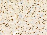 PRMT5 Antibody in Immunohistochemistry (Paraffin) (IHC (P))