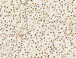 PRMT5 Antibody in Immunohistochemistry (Paraffin) (IHC (P))