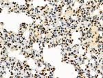 PRMT5 Antibody in Immunohistochemistry (Paraffin) (IHC (P))