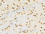 PRMT5 Antibody in Immunohistochemistry (Paraffin) (IHC (P))