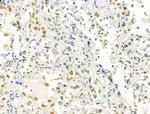 PRMT5 Antibody in Immunohistochemistry (Paraffin) (IHC (P))