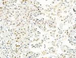 PRMT5 Antibody in Immunohistochemistry (Paraffin) (IHC (P))