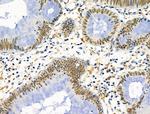 PRMT5 Antibody in Immunohistochemistry (Paraffin) (IHC (P))