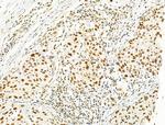 PRMT5 Antibody in Immunohistochemistry (Paraffin) (IHC (P))