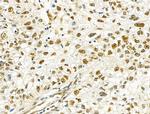 PRMT5 Antibody in Immunohistochemistry (Paraffin) (IHC (P))