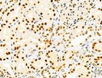 PRMT5 Antibody in Immunohistochemistry (Paraffin) (IHC (P))