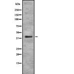 PSMA7 Antibody in Western Blot (WB)