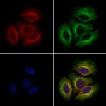 PTCH2 Antibody in Immunocytochemistry (ICC/IF)