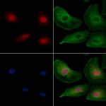 PYGO2 Antibody in Immunocytochemistry (ICC/IF)