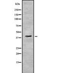 PYGO2 Antibody in Western Blot (WB)