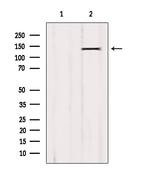 SIK3 Antibody in Western Blot (WB)