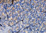 RAB11FIP1 Antibody in Immunohistochemistry (Paraffin) (IHC (P))