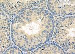 RAB11FIP5 Antibody in Immunohistochemistry (Paraffin) (IHC (P))