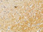 RASGRF2 Antibody in Immunohistochemistry (Paraffin) (IHC (P))