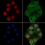 RBM3 Antibody in Immunocytochemistry (ICC/IF)