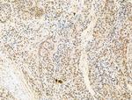 RBM3 Antibody in Immunohistochemistry (Paraffin) (IHC (P))