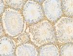 RBM3 Antibody in Immunohistochemistry (Paraffin) (IHC (P))