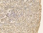 RBM3 Antibody in Immunohistochemistry (Paraffin) (IHC (P))