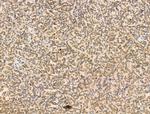 RBM3 Antibody in Immunohistochemistry (Paraffin) (IHC (P))