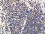 RBM3 Antibody in Immunohistochemistry (Paraffin) (IHC (P))