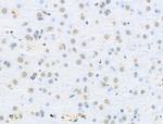 RBM3 Antibody in Immunohistochemistry (Paraffin) (IHC (P))