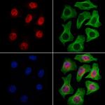 RECQL5 Antibody in Immunocytochemistry (ICC/IF)