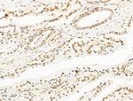 RECQL5 Antibody in Immunohistochemistry (Paraffin) (IHC (P))