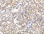 RECQL5 Antibody in Immunohistochemistry (Paraffin) (IHC (P))