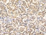 RECQL5 Antibody in Immunohistochemistry (Paraffin) (IHC (P))