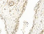 RECQL5 Antibody in Immunohistochemistry (Paraffin) (IHC (P))