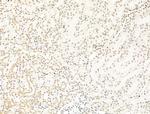 RECQL5 Antibody in Immunohistochemistry (Paraffin) (IHC (P))