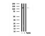 RB1 Antibody in Western Blot (WB)