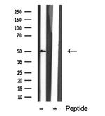 RARA/RARB Antibody in Western Blot (WB)