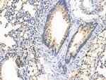 RPS29 Antibody in Immunohistochemistry (Paraffin) (IHC (P))