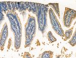 RPS29 Antibody in Immunohistochemistry (Paraffin) (IHC (P))