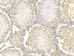 RPS29 Antibody in Immunohistochemistry (Paraffin) (IHC (P))