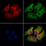 RNF31 Antibody in Immunocytochemistry (ICC/IF)