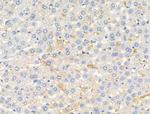 RNF31 Antibody in Immunohistochemistry (Paraffin) (IHC (P))