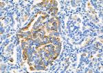 ROBO1 Antibody in Immunohistochemistry (Paraffin) (IHC (P))